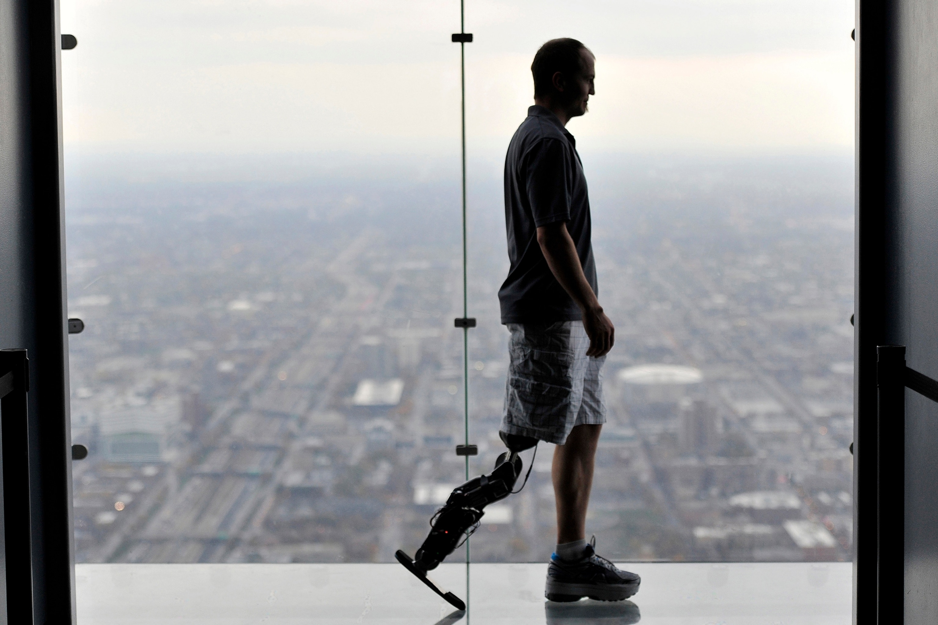 Dennis Aabo Sorensen tests a prosthetic arm with sensory feedback in a laboratory in Rome in March 2013.