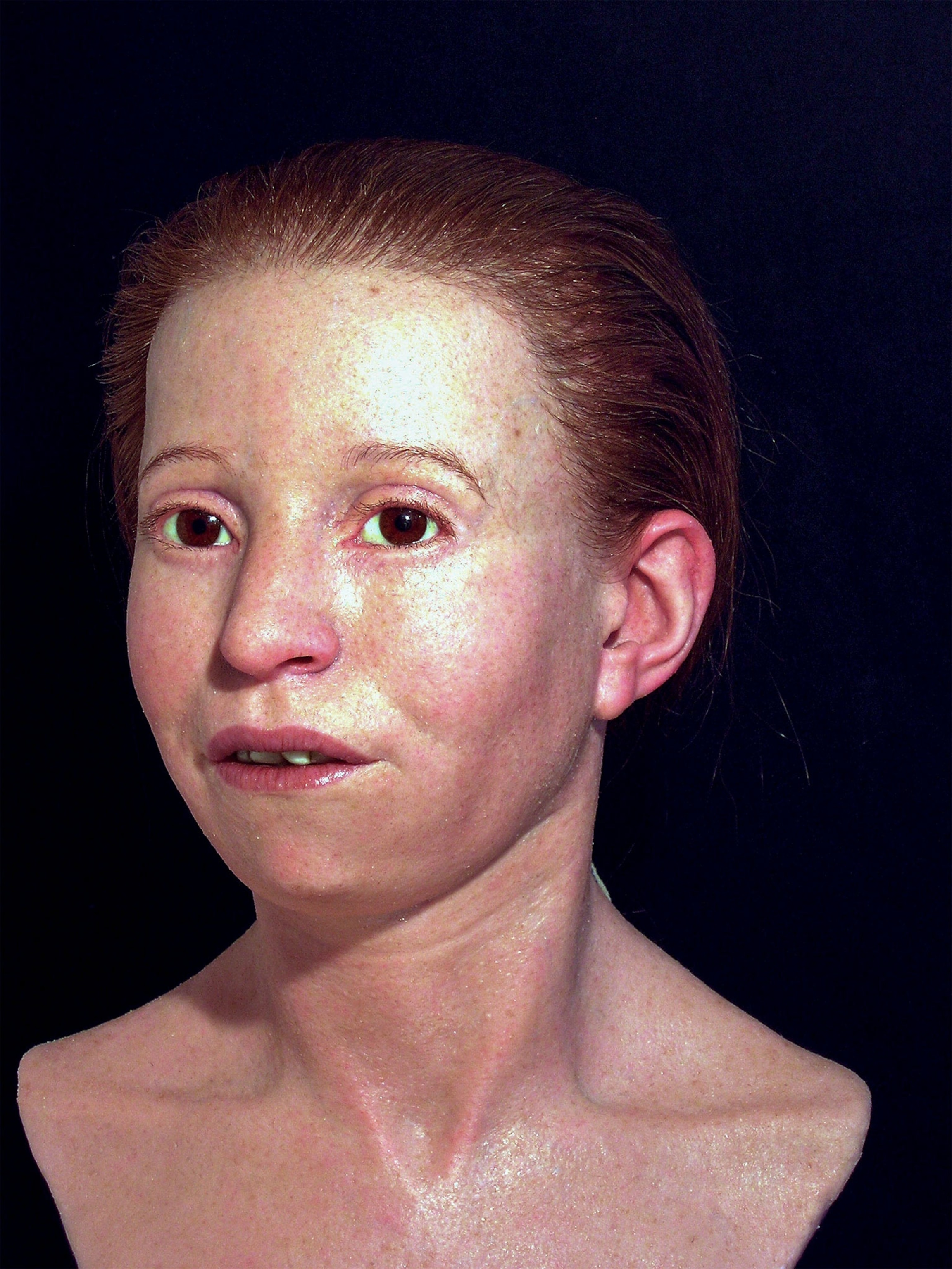 Myrtis facial reconstruction