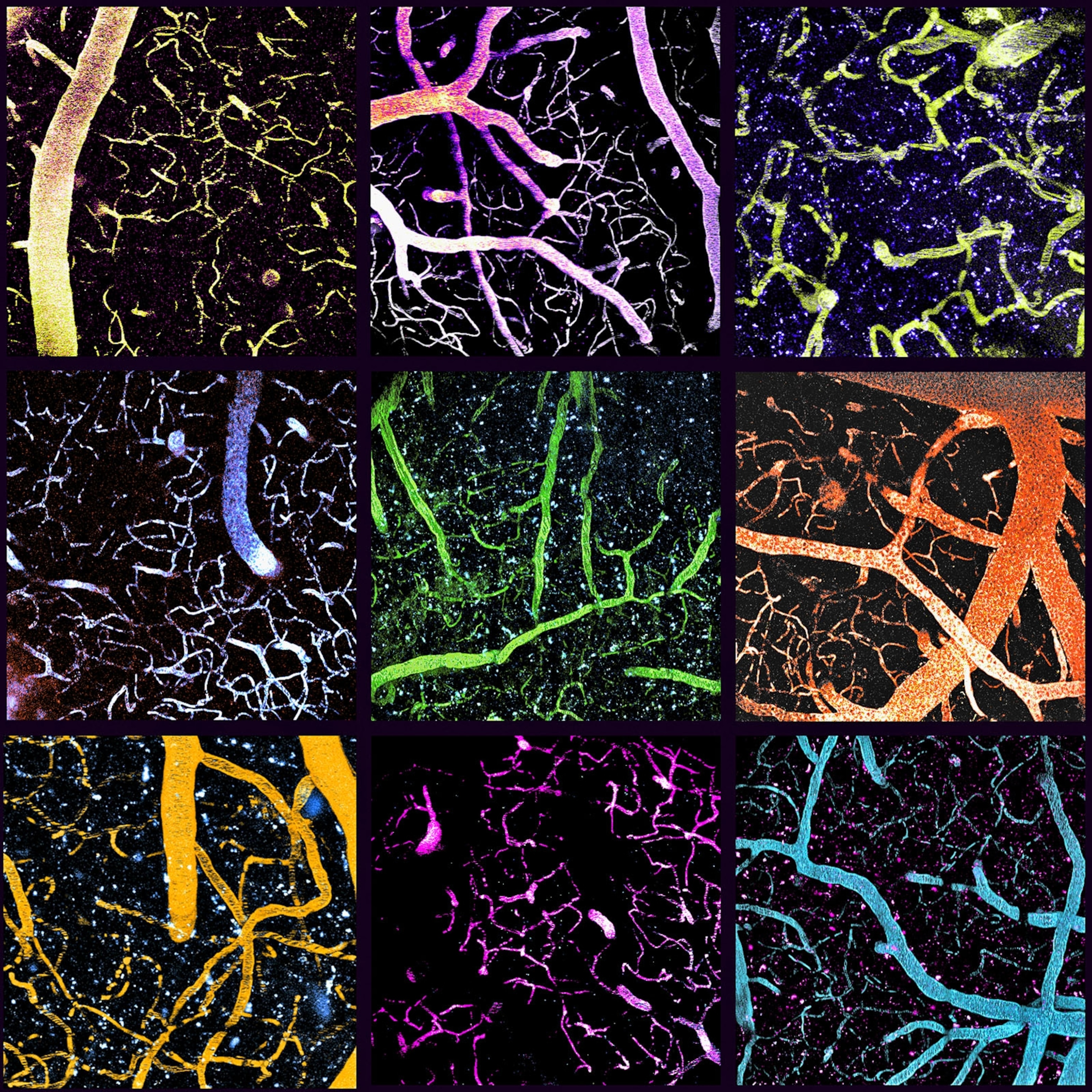 Picture of man brain cells