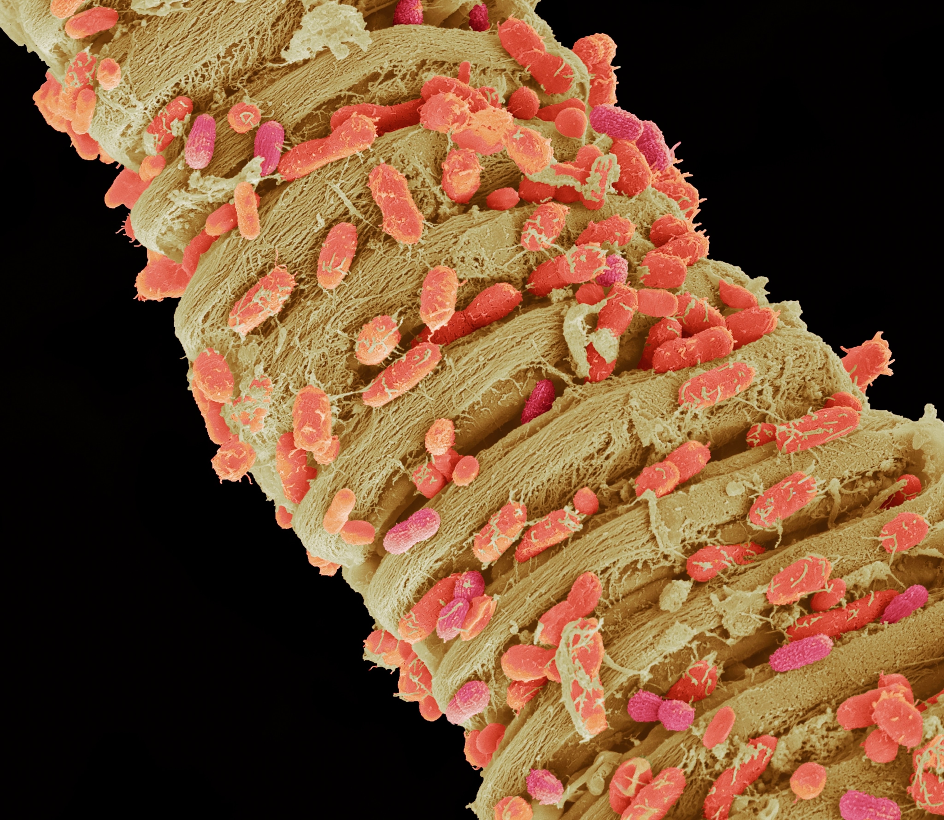 A colorized micrographic view of hundreds of pink and red rod-shaped bacteria embedded within the folds of feces.