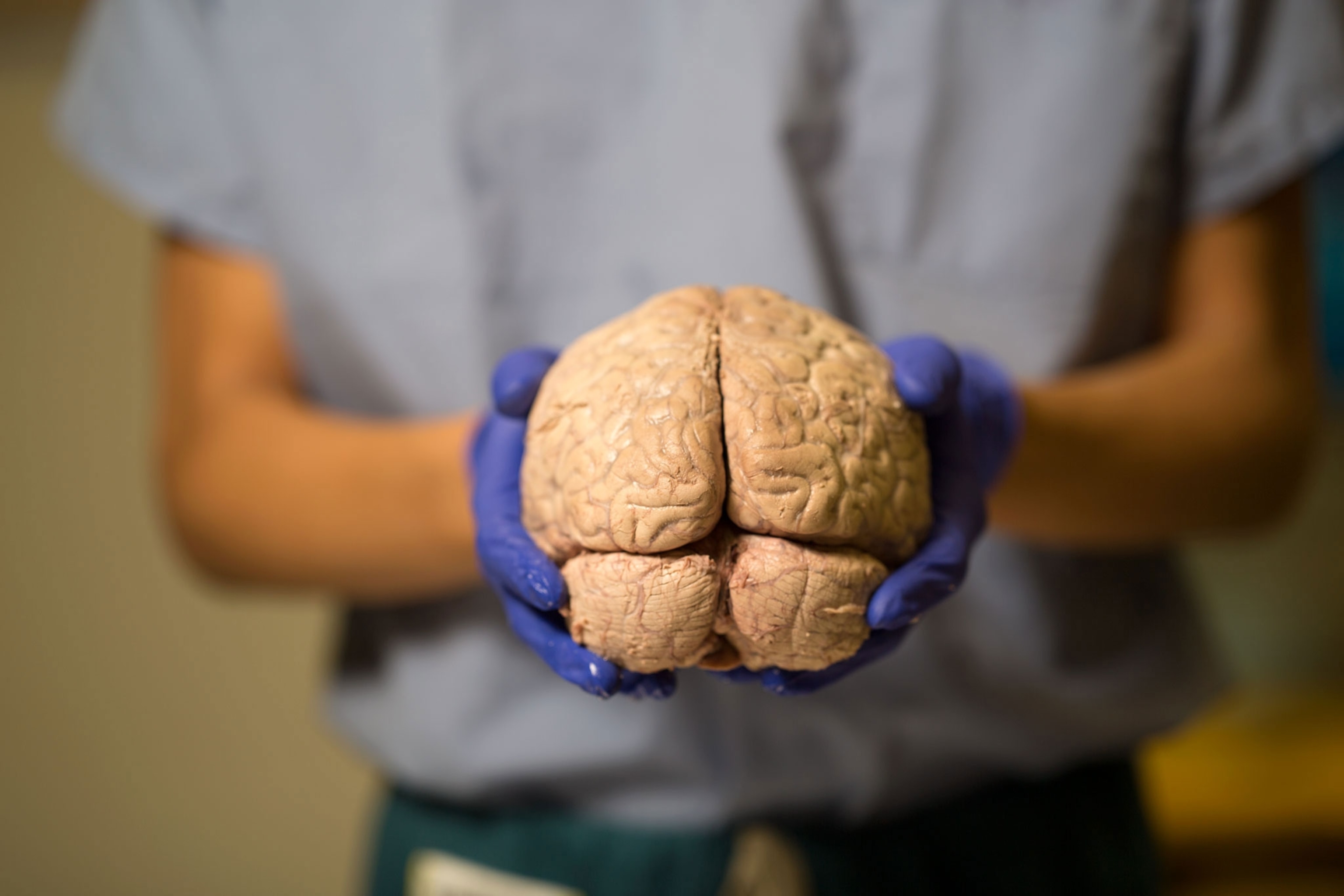 a brain