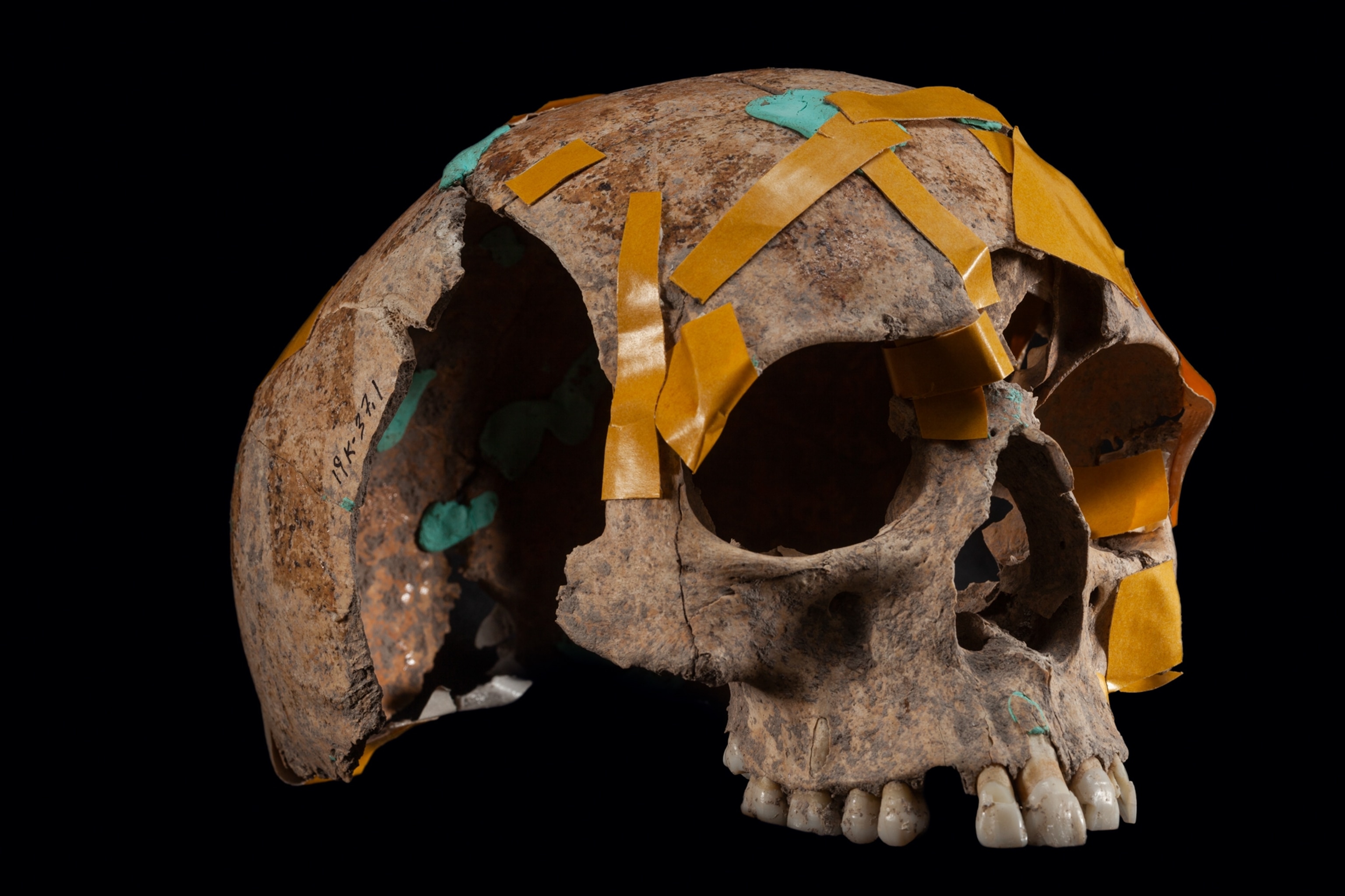 human skull with parts taped together.