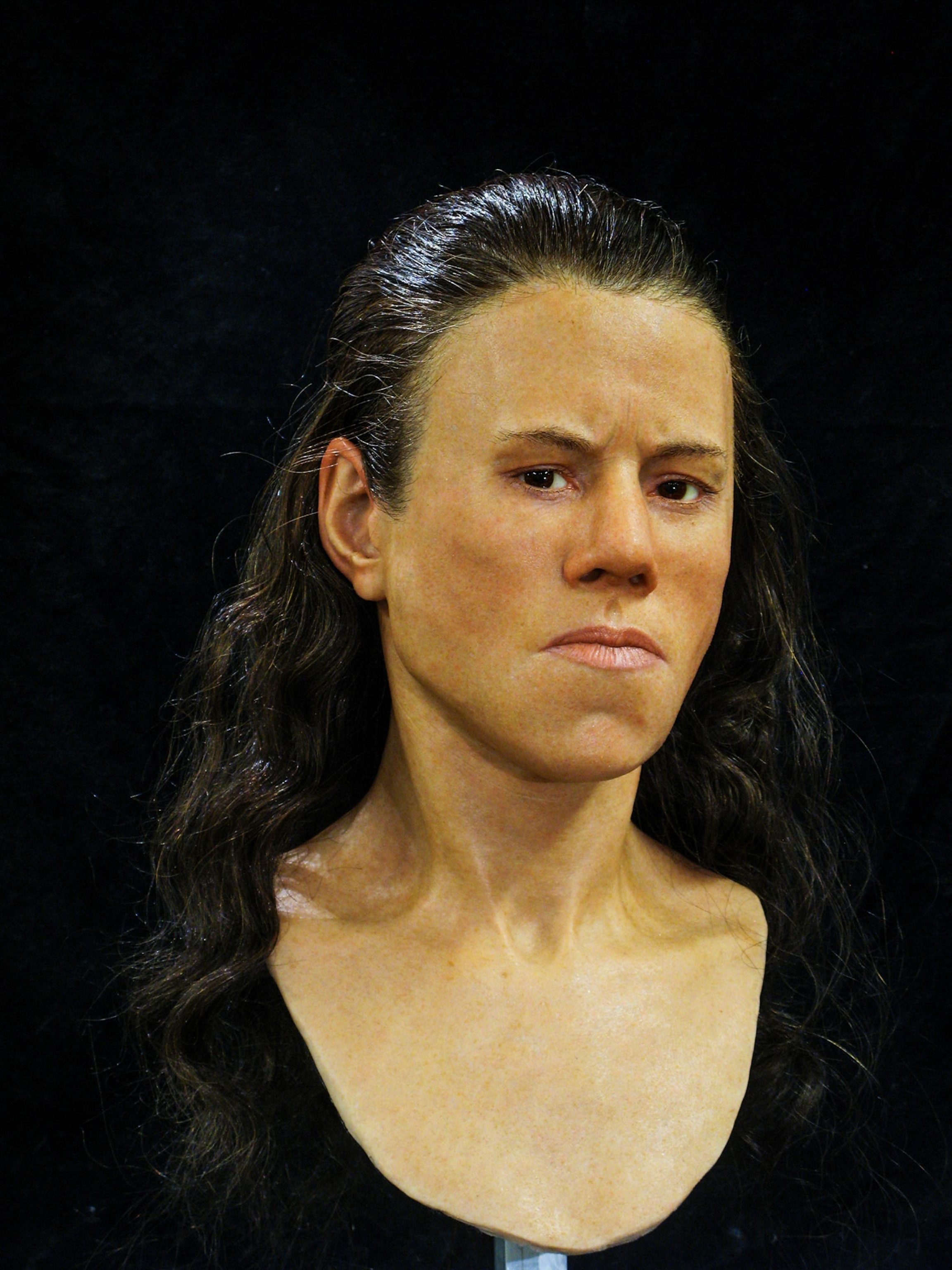 Avgi facial reconstruction