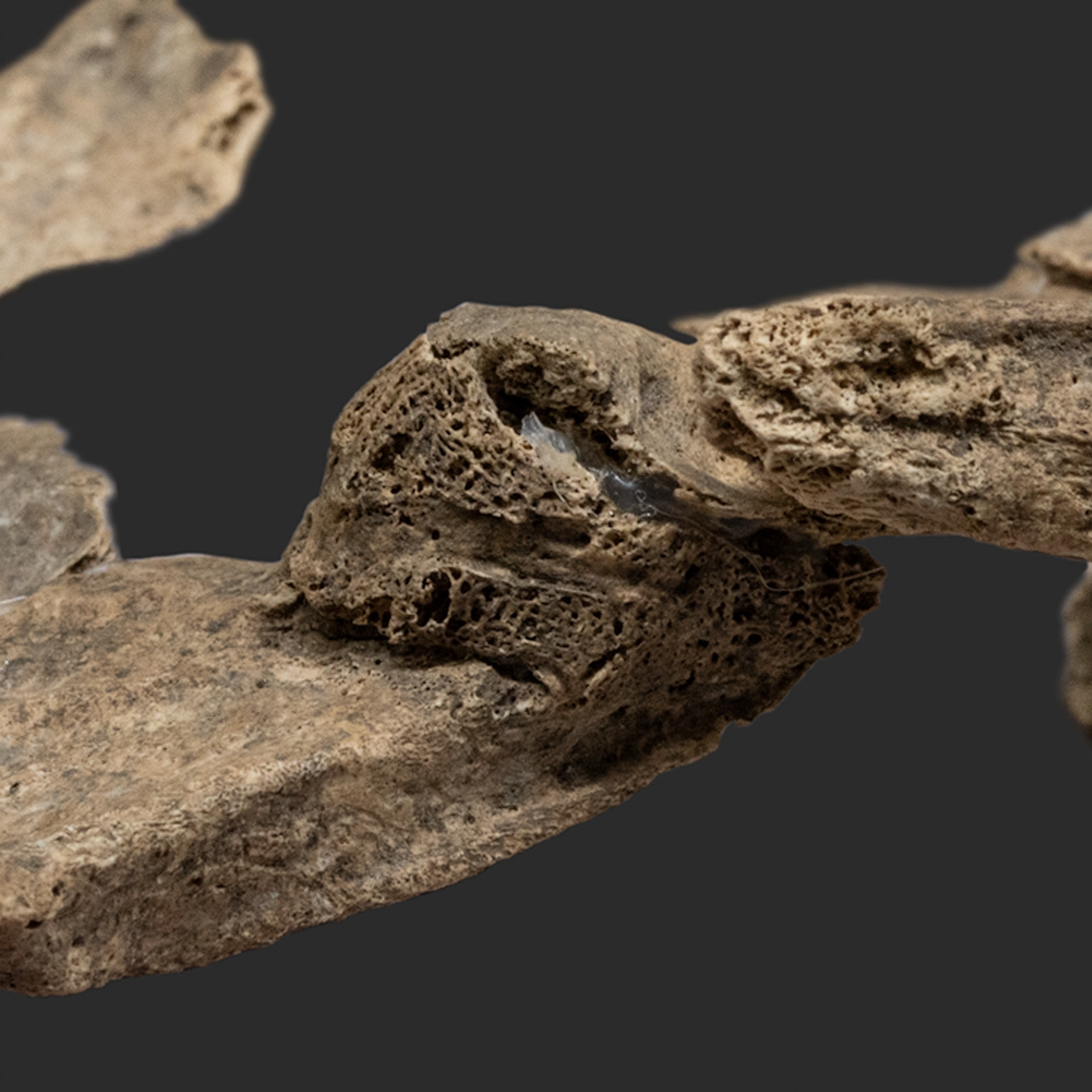 A detailed view of thick bone growth where the warrior's scapula was fractured and eventually healed.