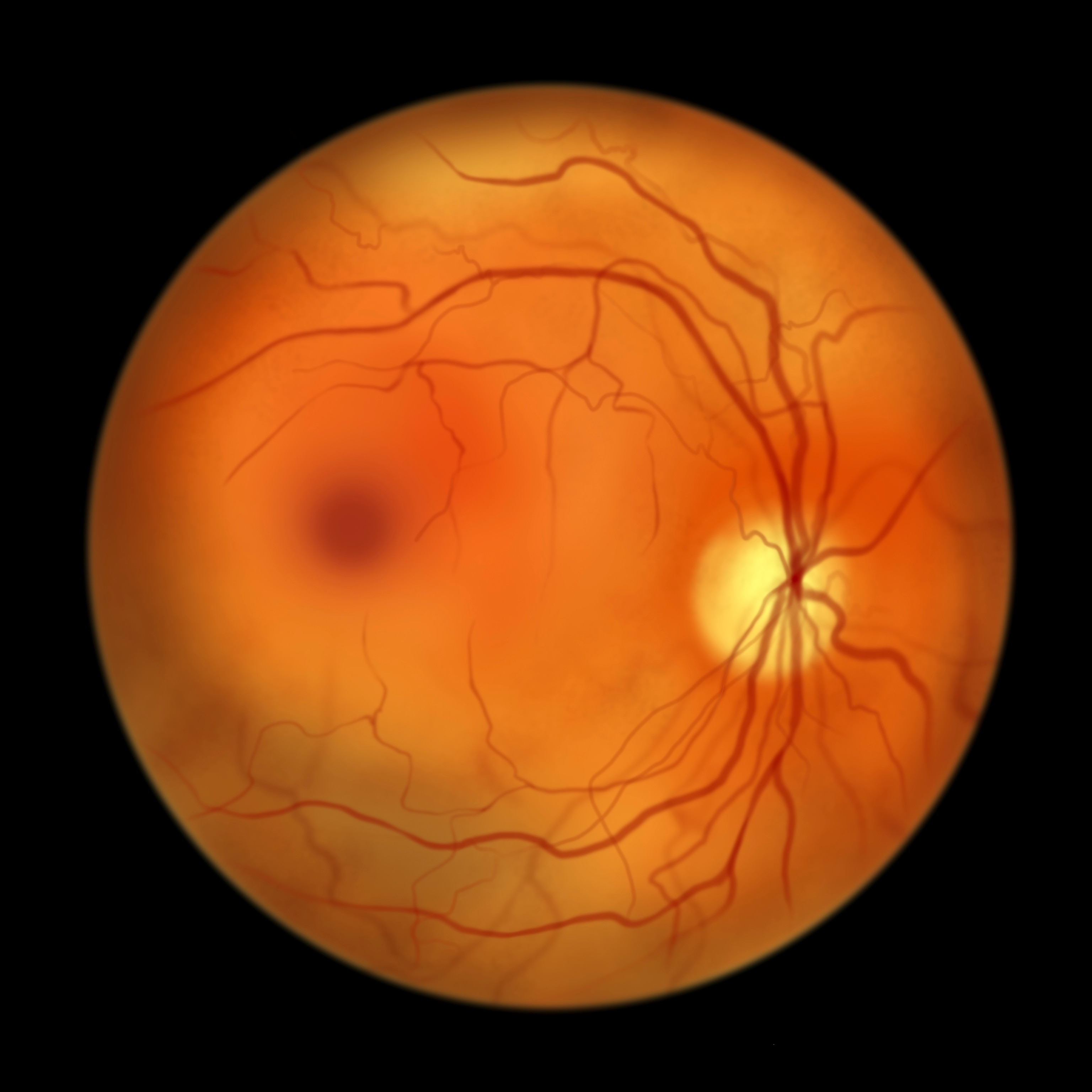 An orange circle representing a scan of a healthy retina of a human eye.