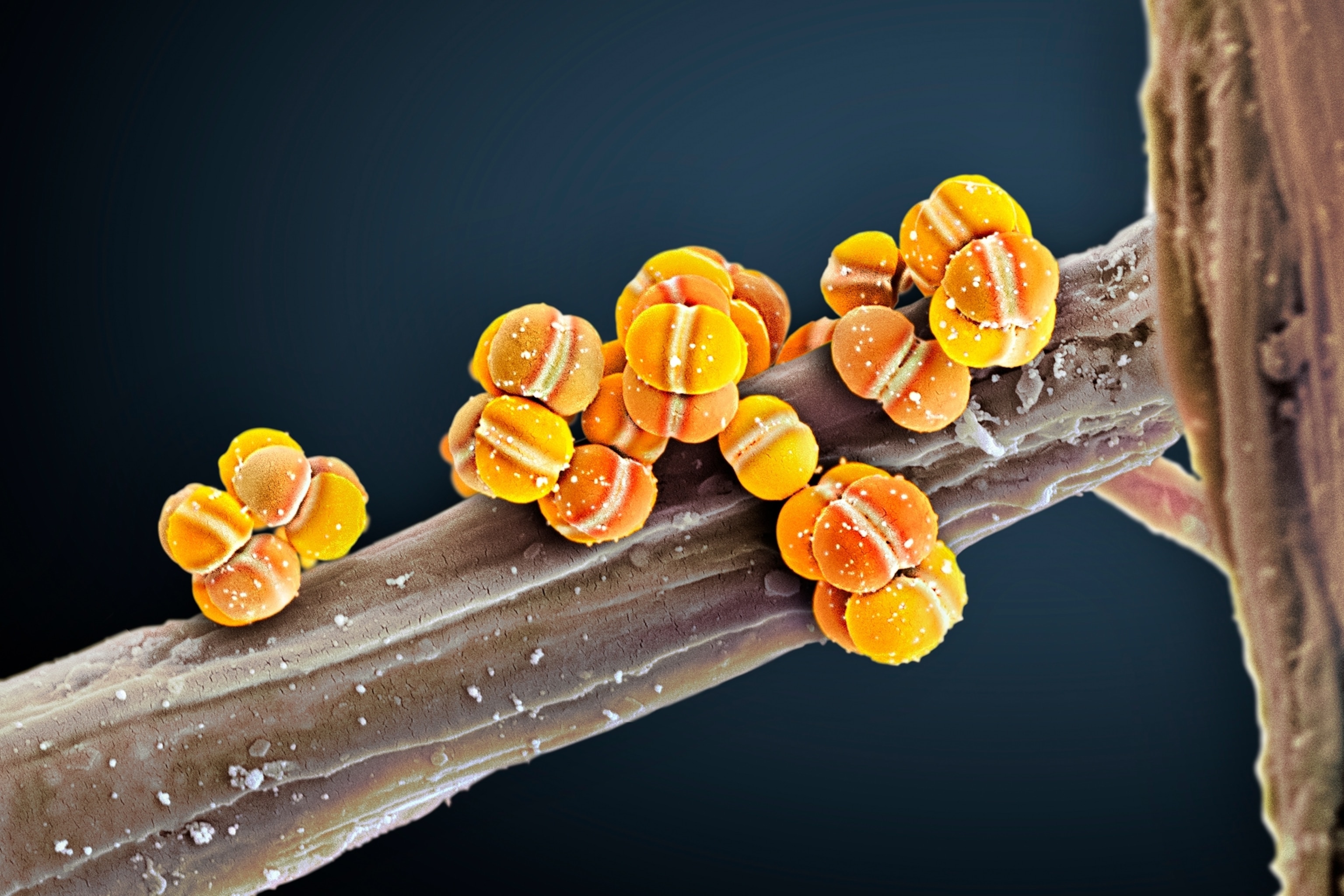 orange bacteria