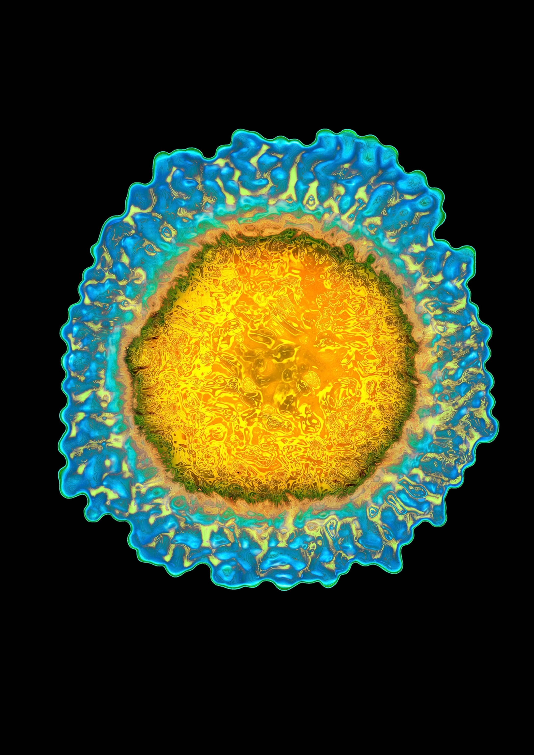 influenza flu.