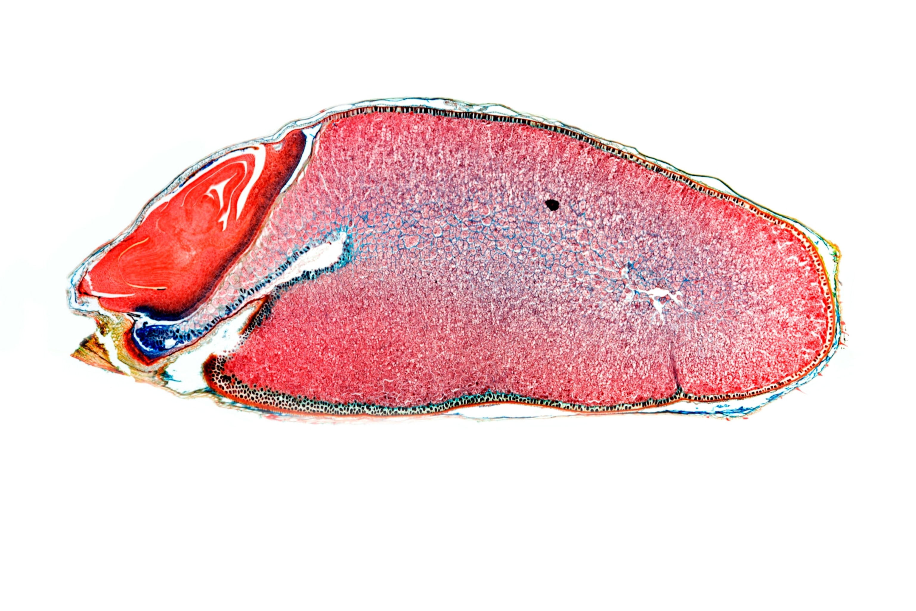 Light micrograph of a wheat grain, the seed of the wheat plant