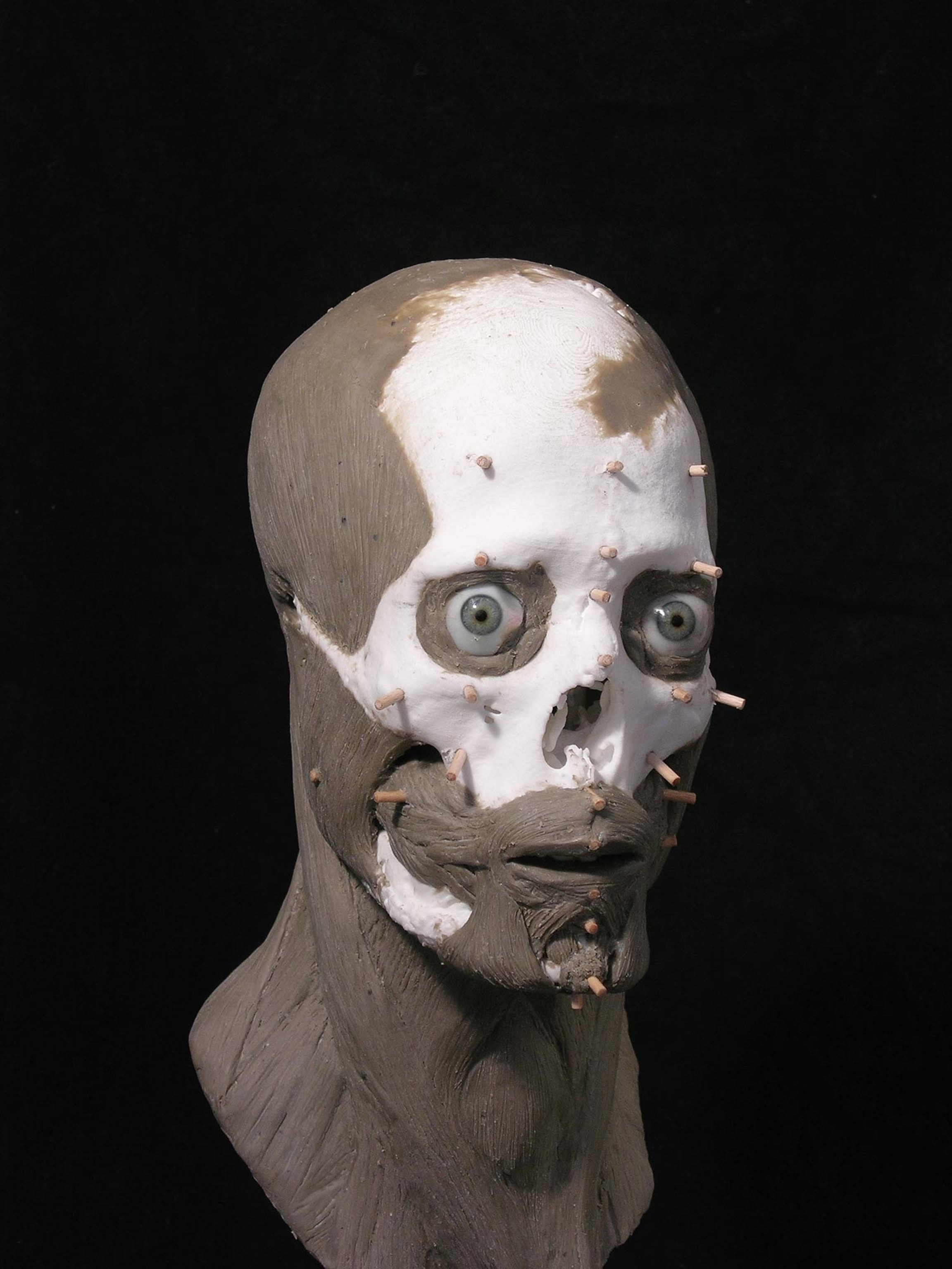 Bocksten Man's facial reconstruction with cheeks, eyes, and a chin
