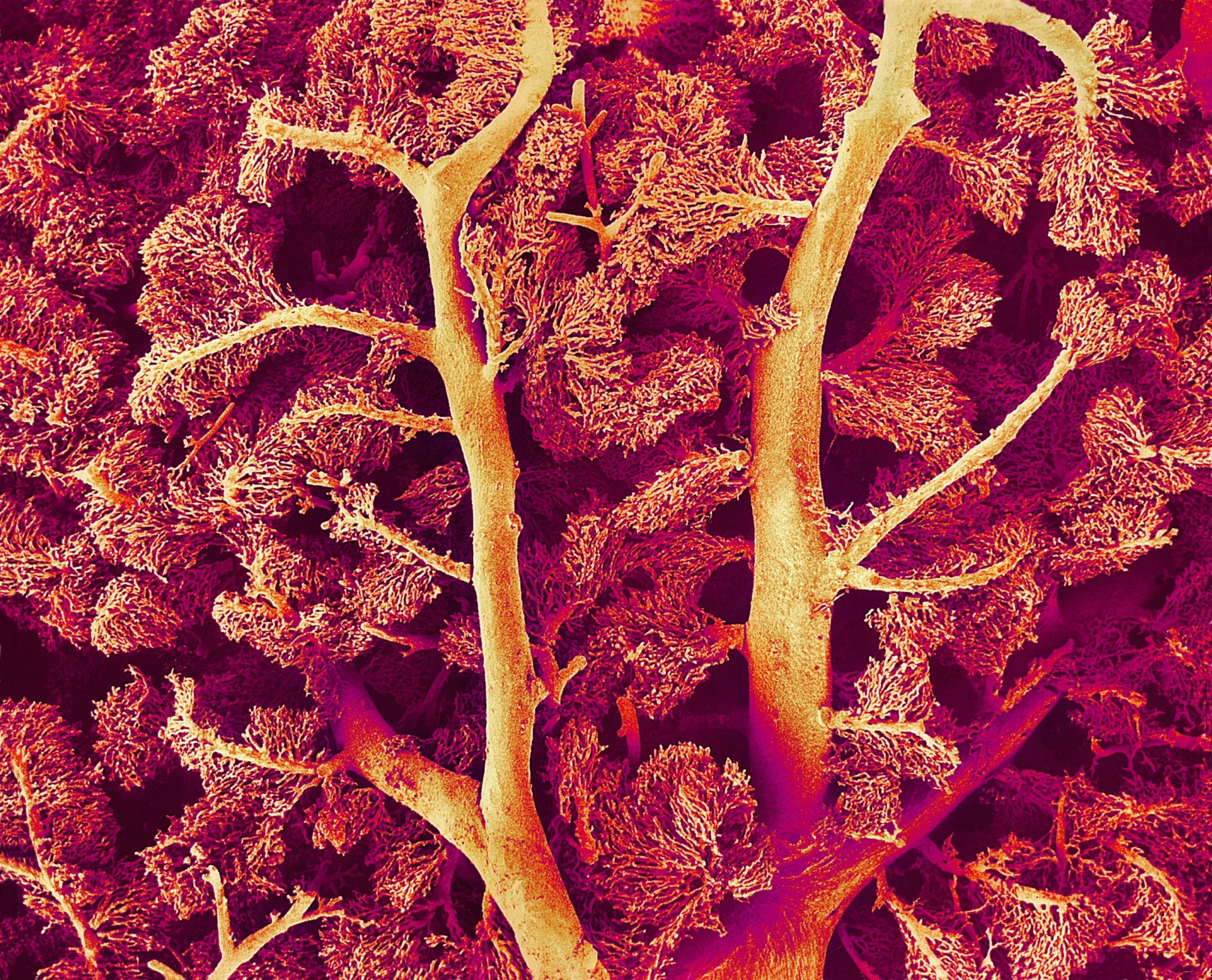 A microscopic view of a cast made from the blood vessels of a human liver.