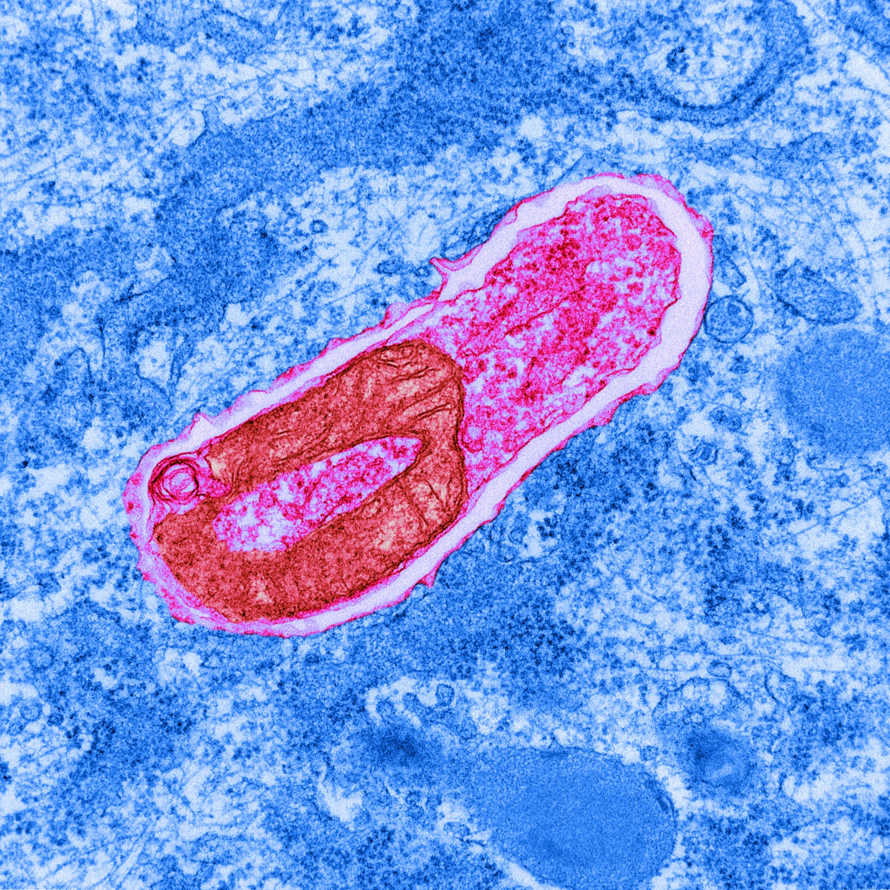 Color enhanced Transmission Electron Micrograph (TEM) of cell undergoing autophagocytosis.