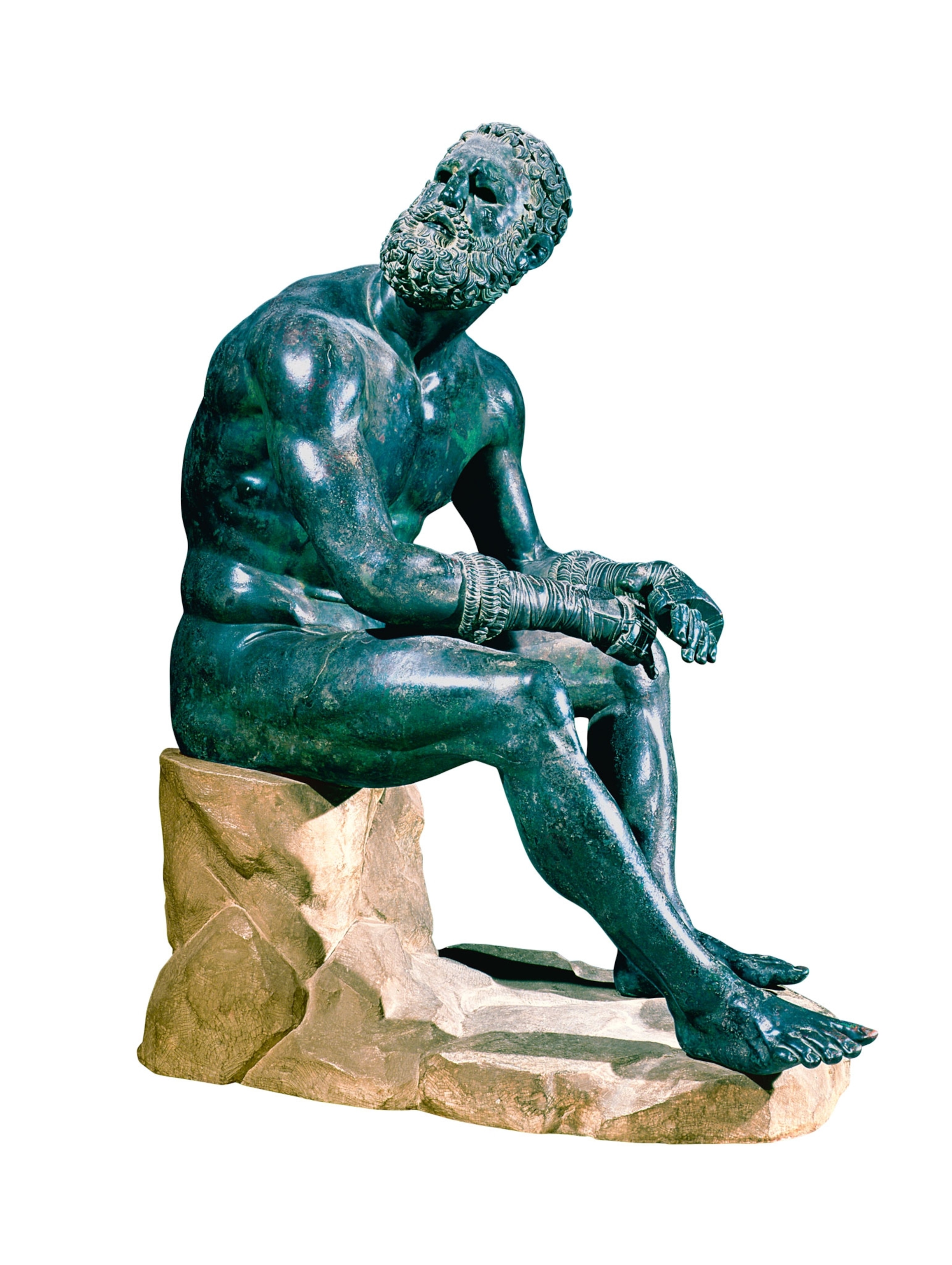 a statue of a boxer sitting looking up