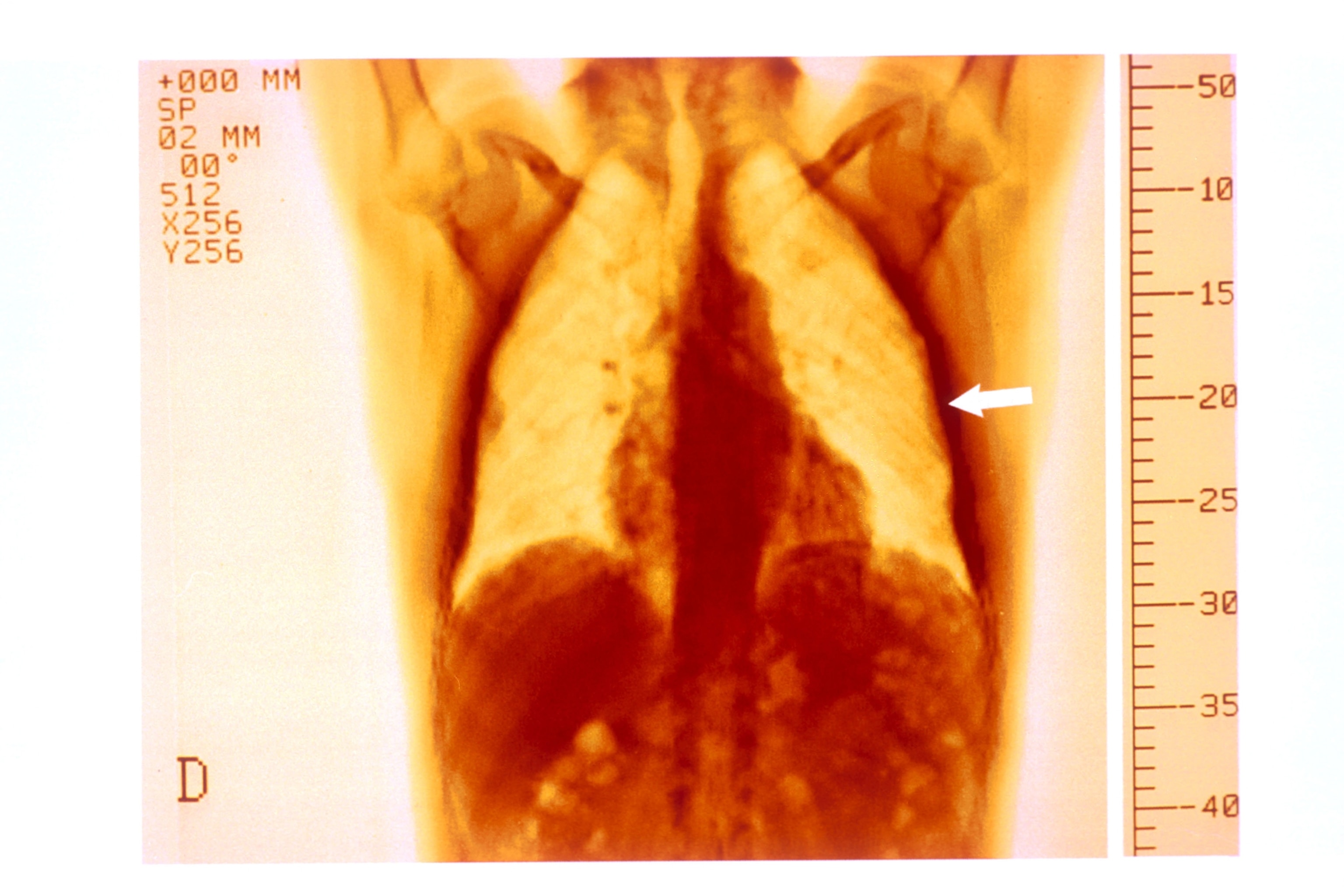A scan of lungs.
