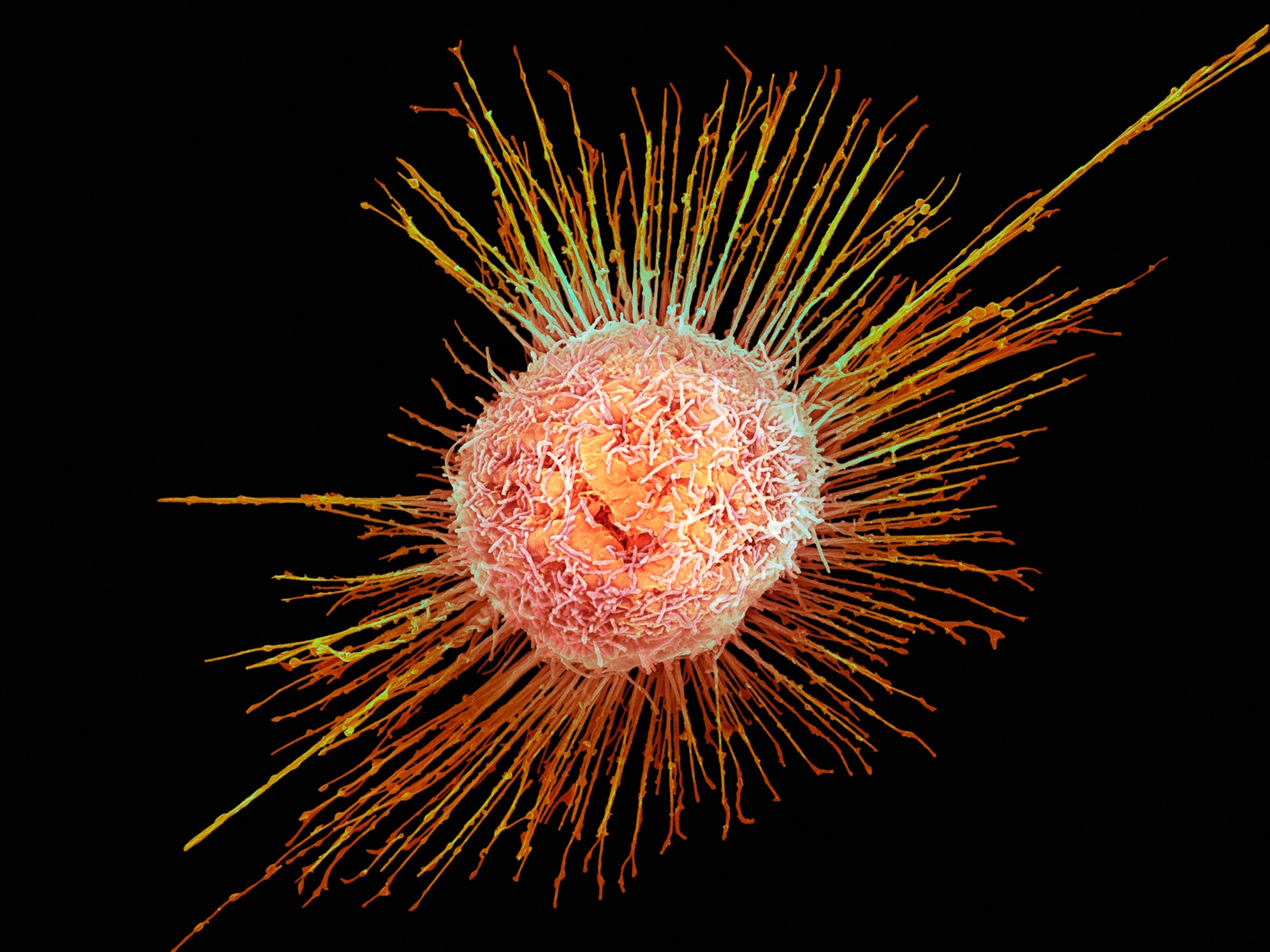 A colorized micrographic view of a single H1N1 virus particle, which appears as a round body with hundreds of spindly arms