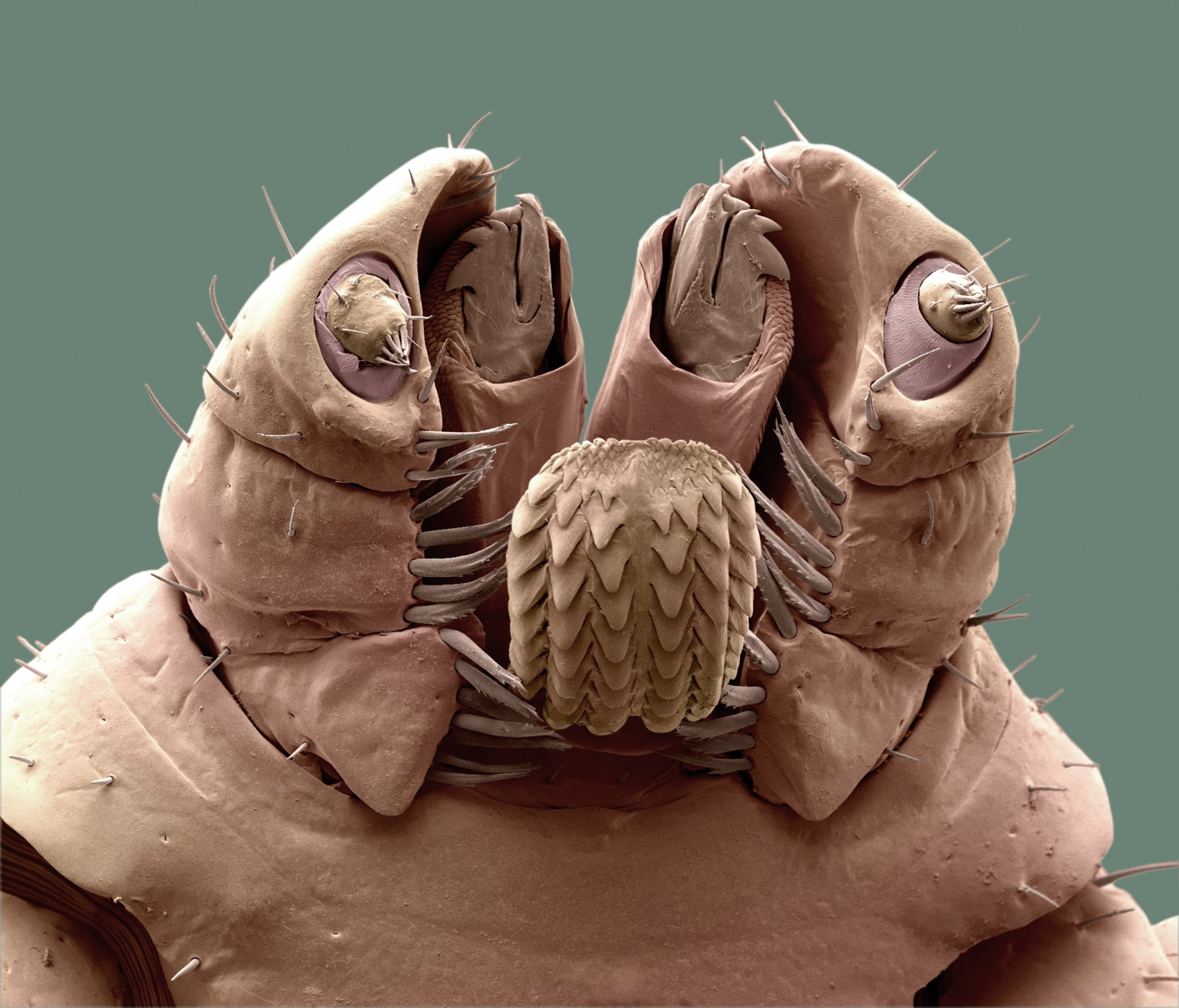 Picture of the head of a brown dog tick, as seen using a scanning electron microscope.