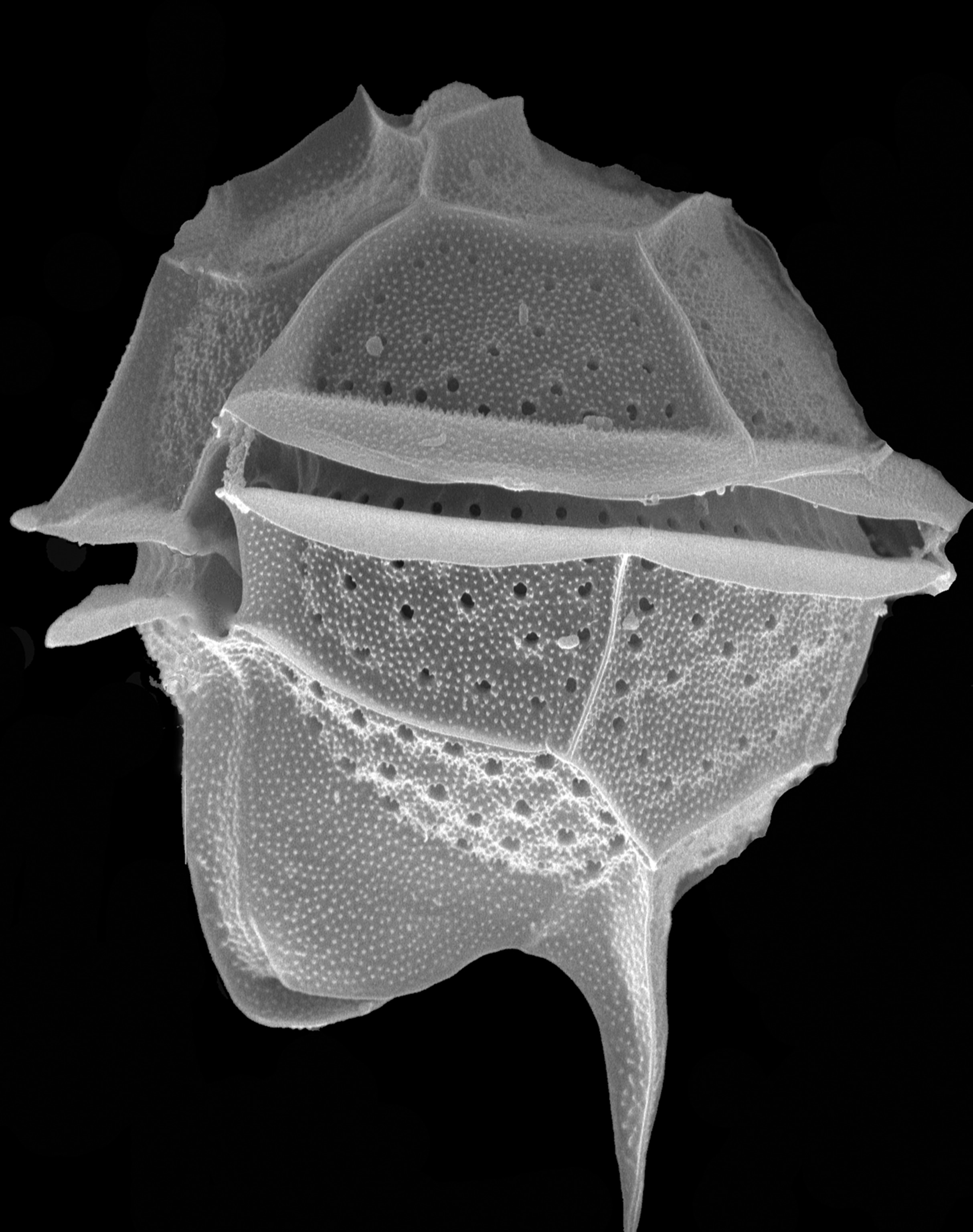 Pyrodinium bahamense as seen through a scanning electron micrograph