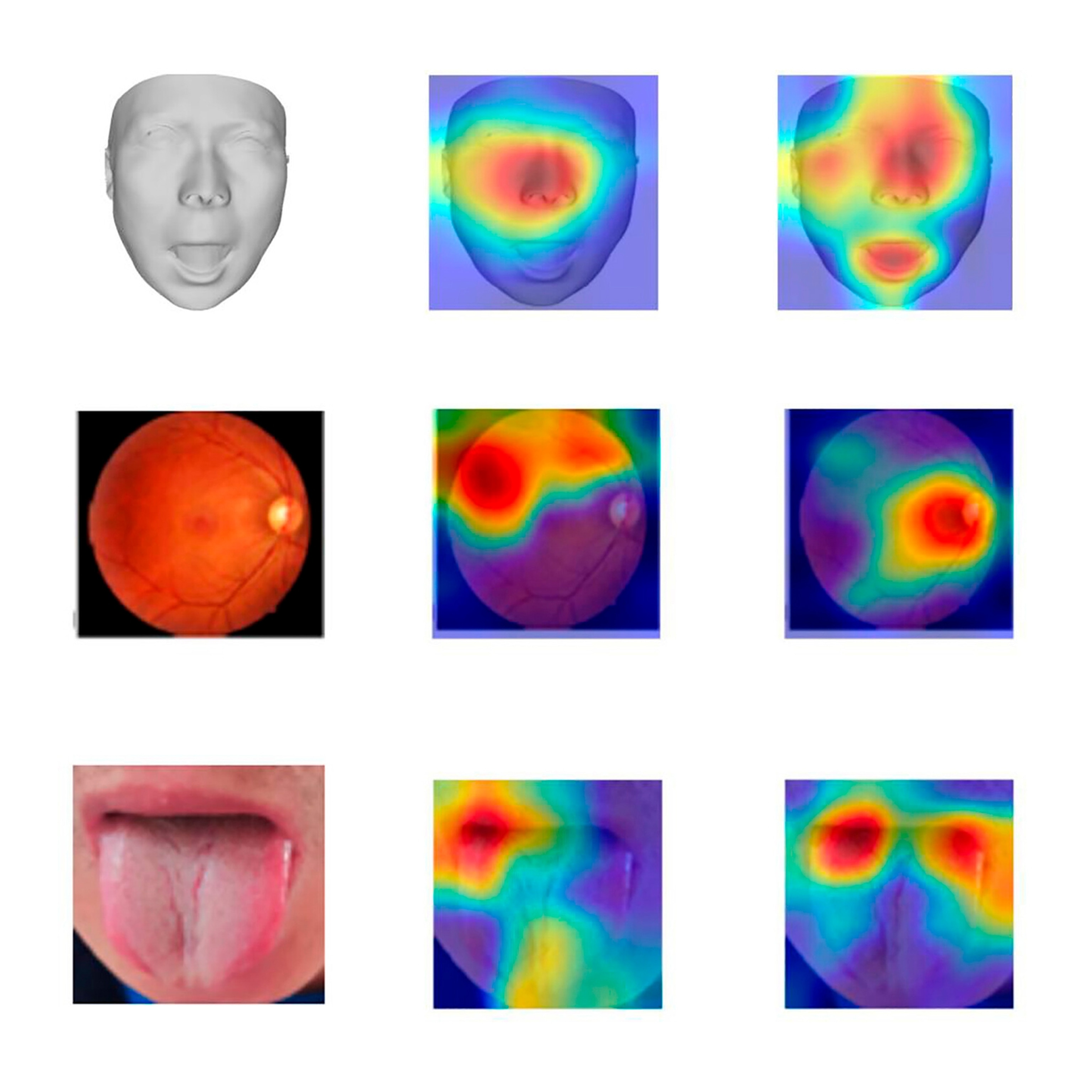 A grid of images based on the first column of a generic face, a fundoscopic view of a retina, and a photo of a tongue; the proceeding columns show map key areas for identifying age
