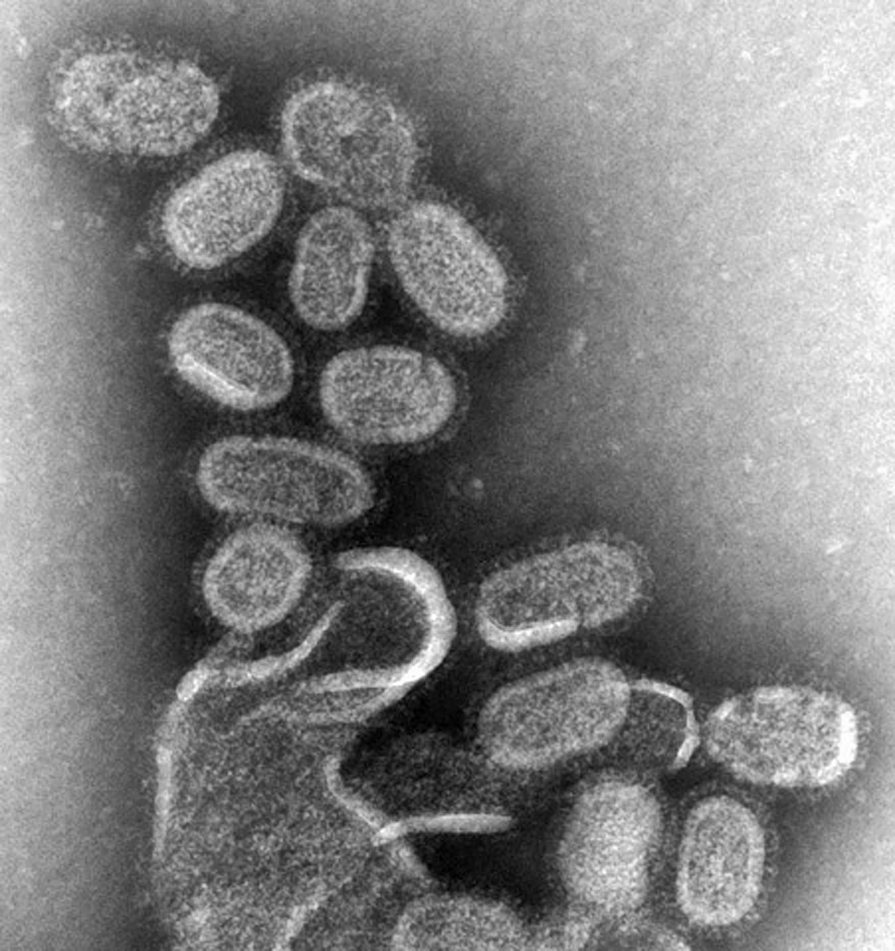 Negative-stained TEM shows recreated 1918 influenza virions that were collected from the supernatant of a 1918-infected Madin-Darby Canine Kidney (MDCK) cell culture, 18 hours after infection.