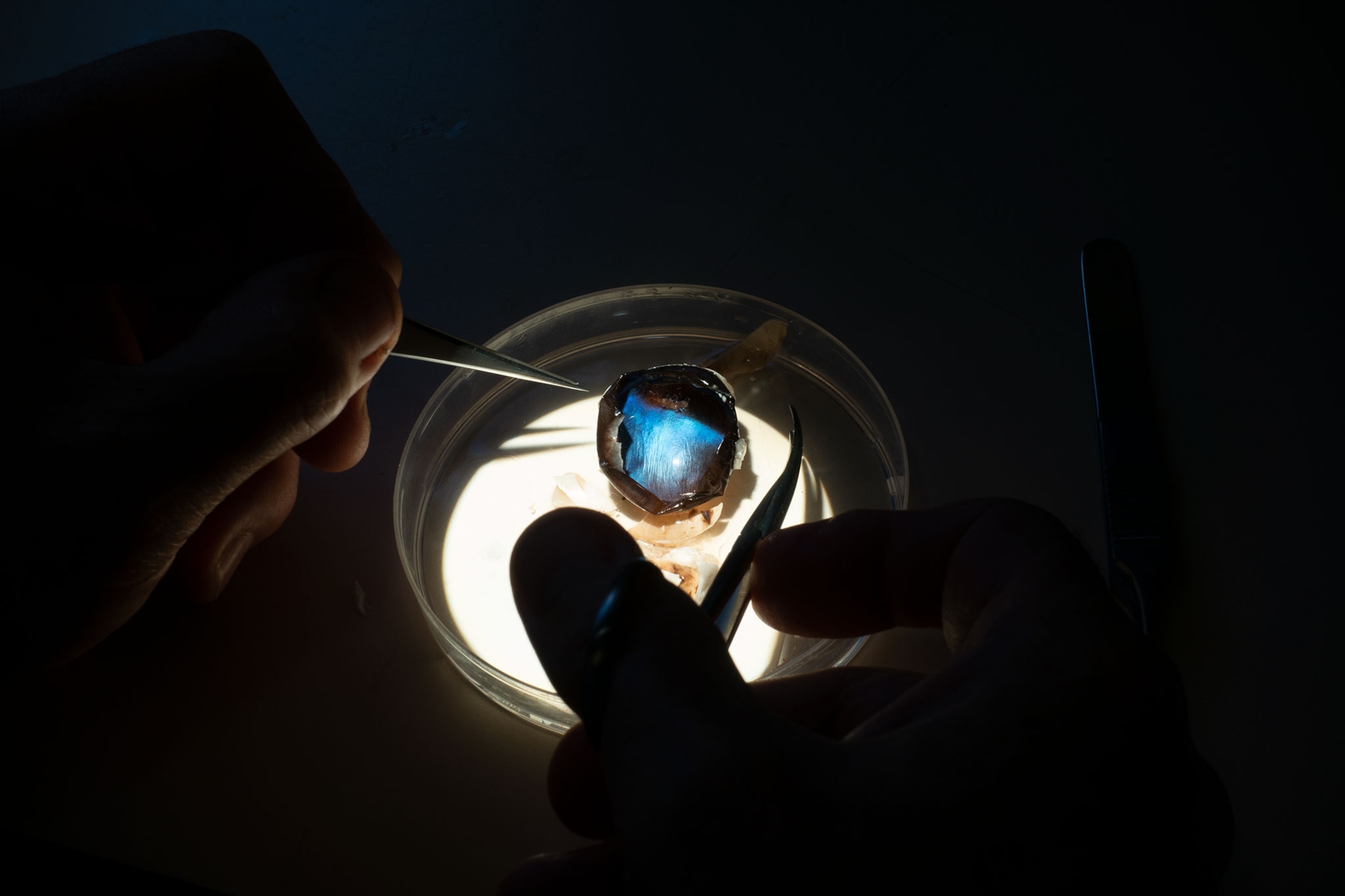 Hands above petri dish with blue light illuminating from eye being dissected.