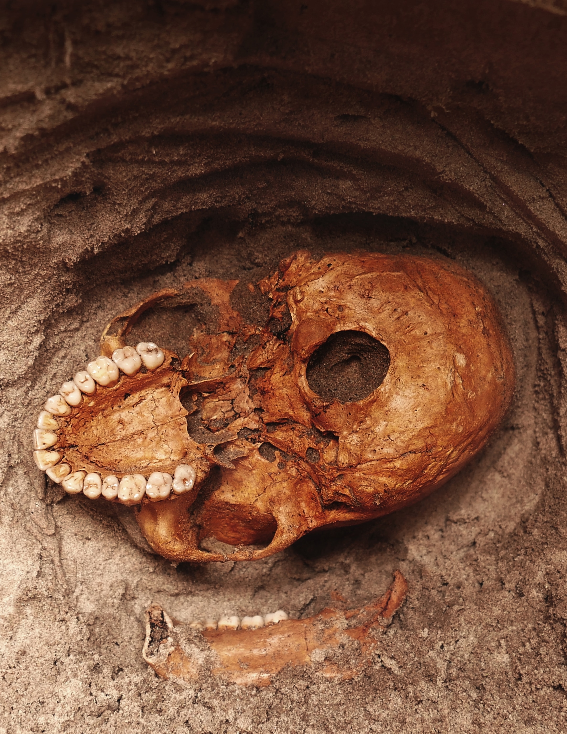 skull