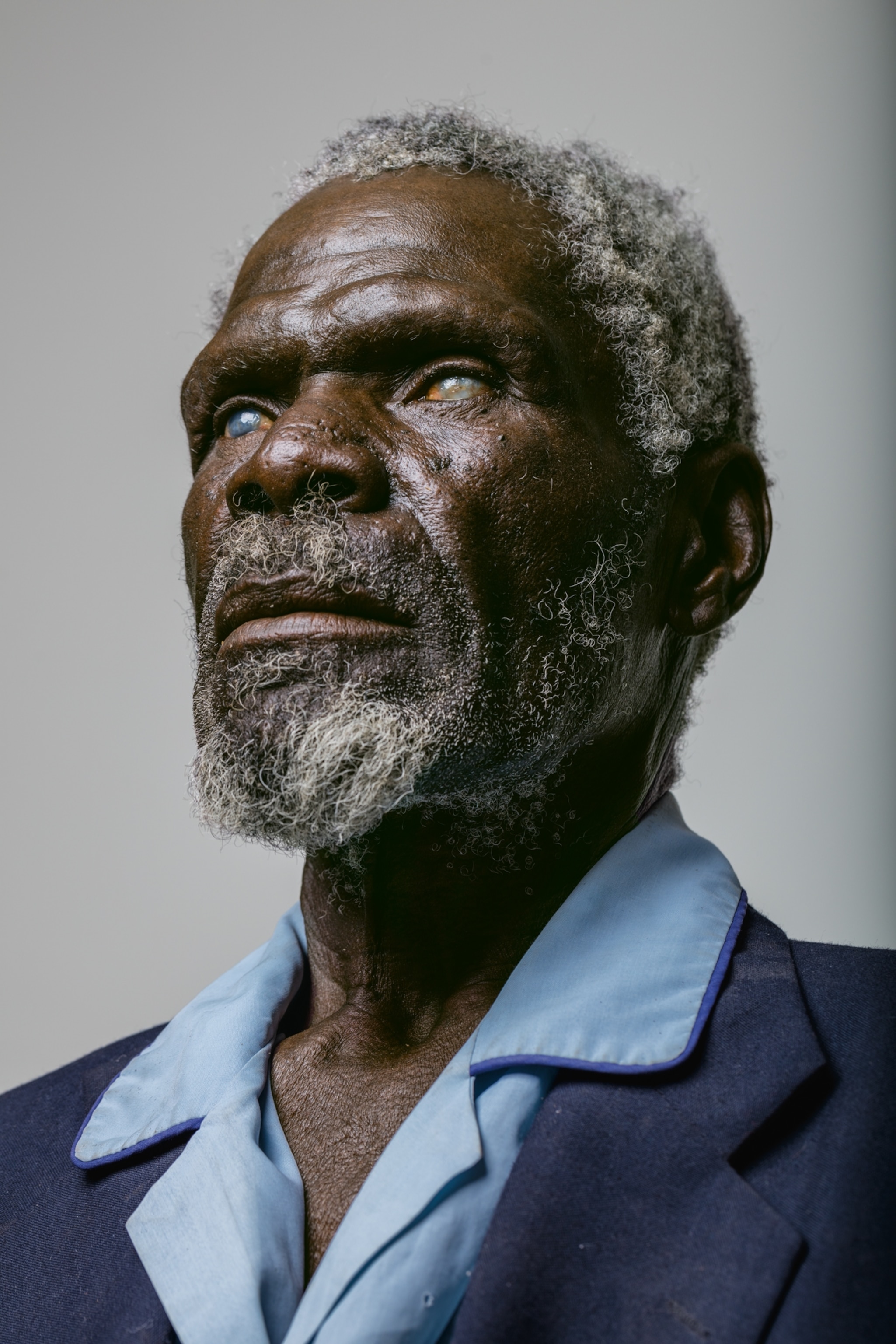 a farmer whose corneas have been destroyed by years of Namibian sun and dust