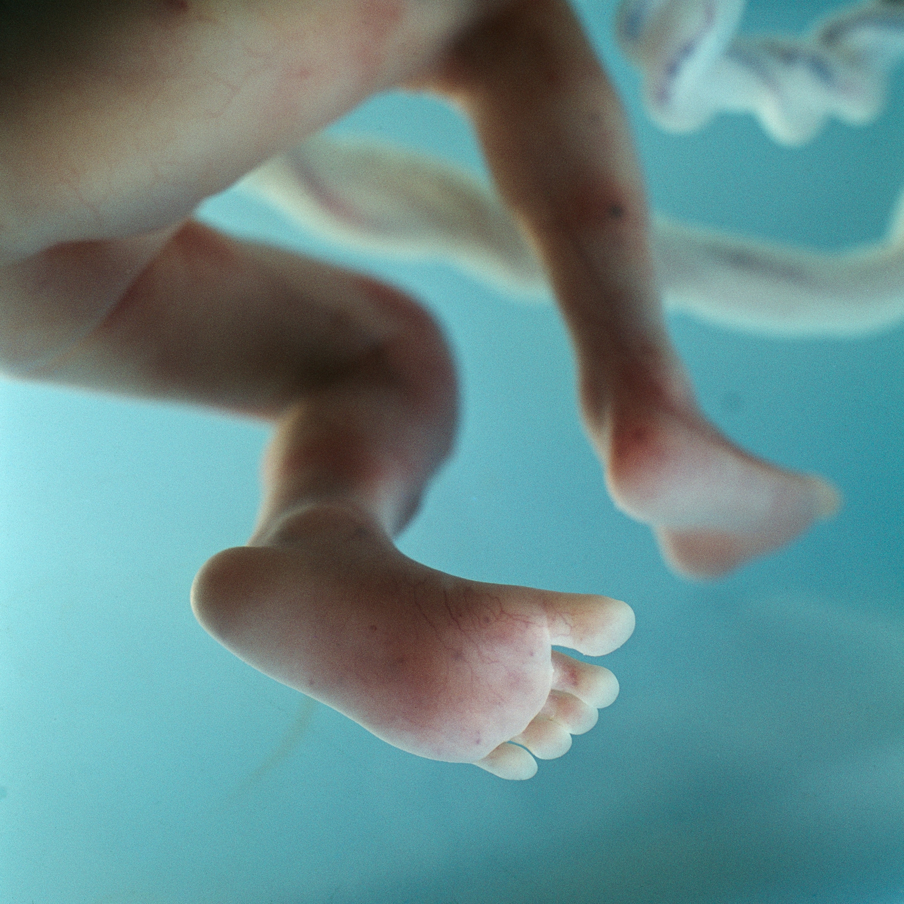 Bright blue behind the small legs of a floating fetus pale skin and umbilical cord.