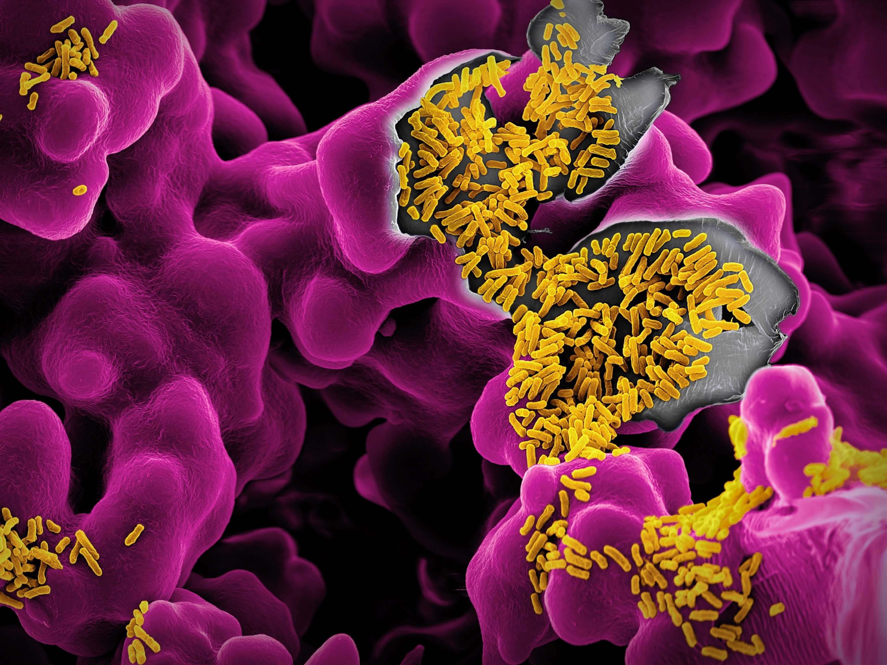 A colorized microscopic view of E. coli, which appear as small yellow rods covering a purple surface.